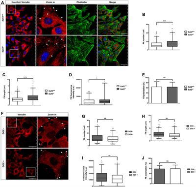 The Sall2 transcription factor promotes cell migration regulating focal adhesion turnover and integrin β1 expression